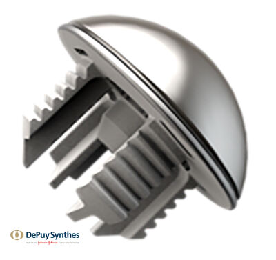 Global-ICON-Implantat