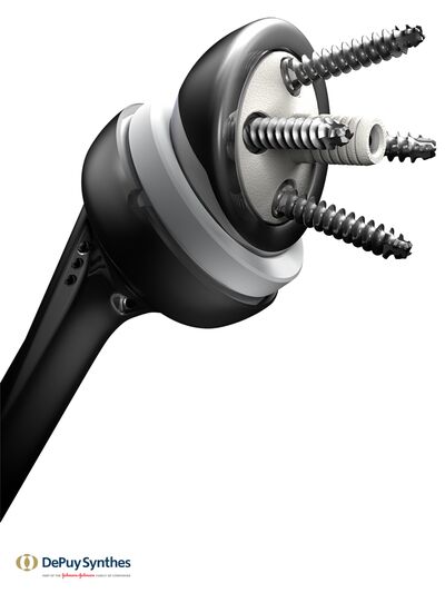 Delta-Xtend-Cemented-Stem-01-Kopie